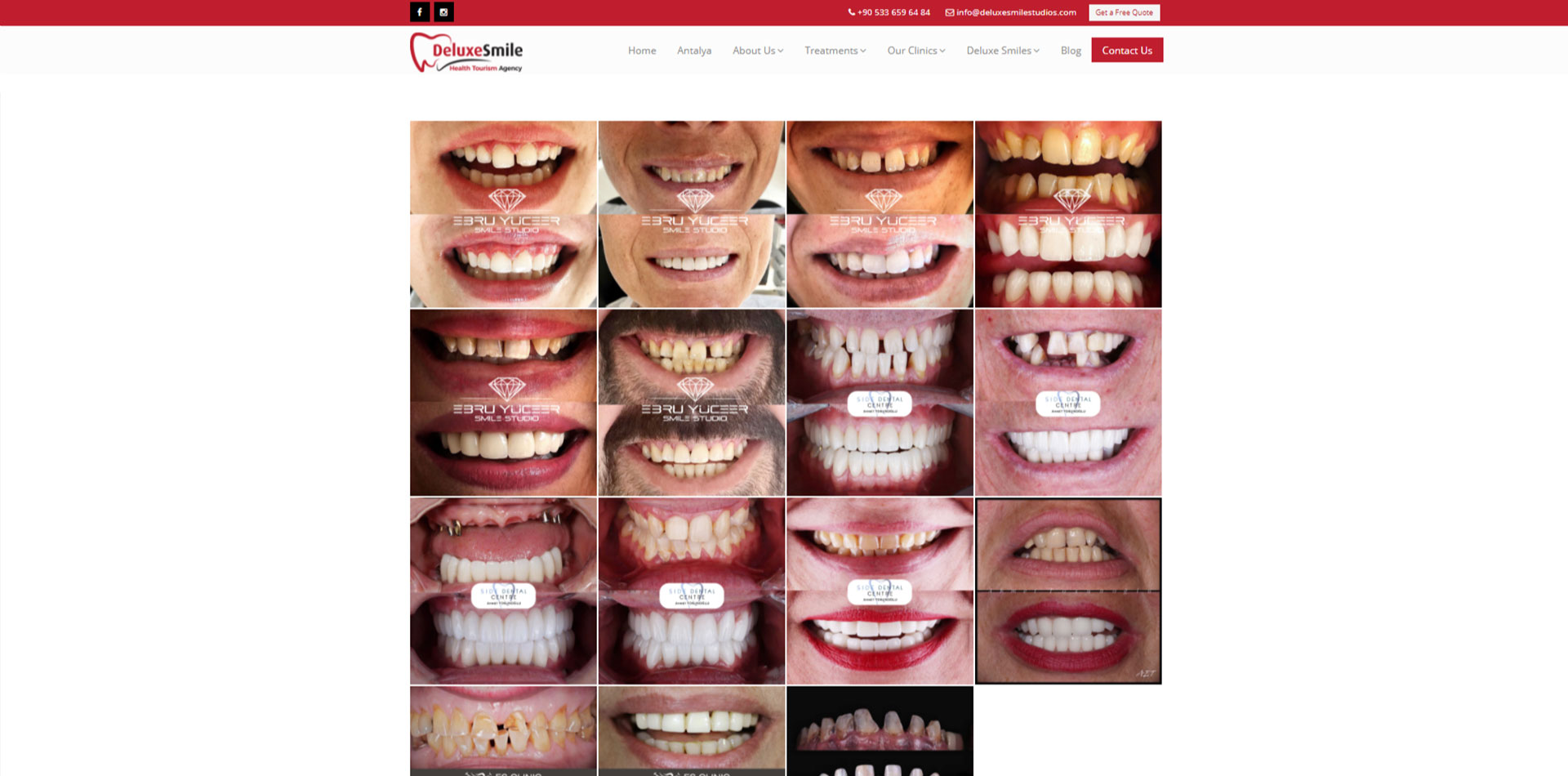 antalya sağlık turizmi web sitesi, antalya sağlık web sitesi, antalya web sitesi