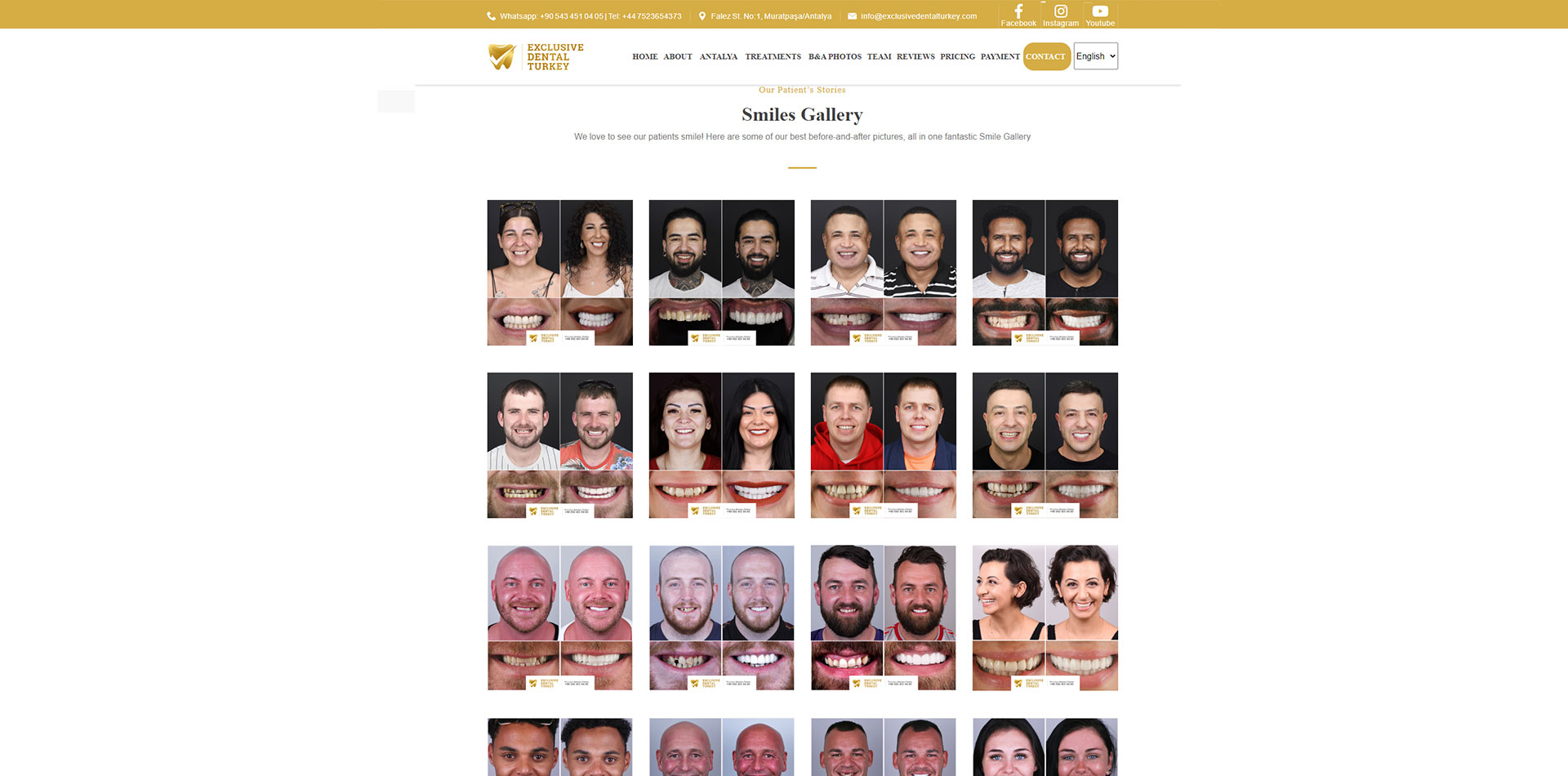 antalya sağlık turizmi web sitesi, antalya sağlık web sitesi, antalya web sitesi